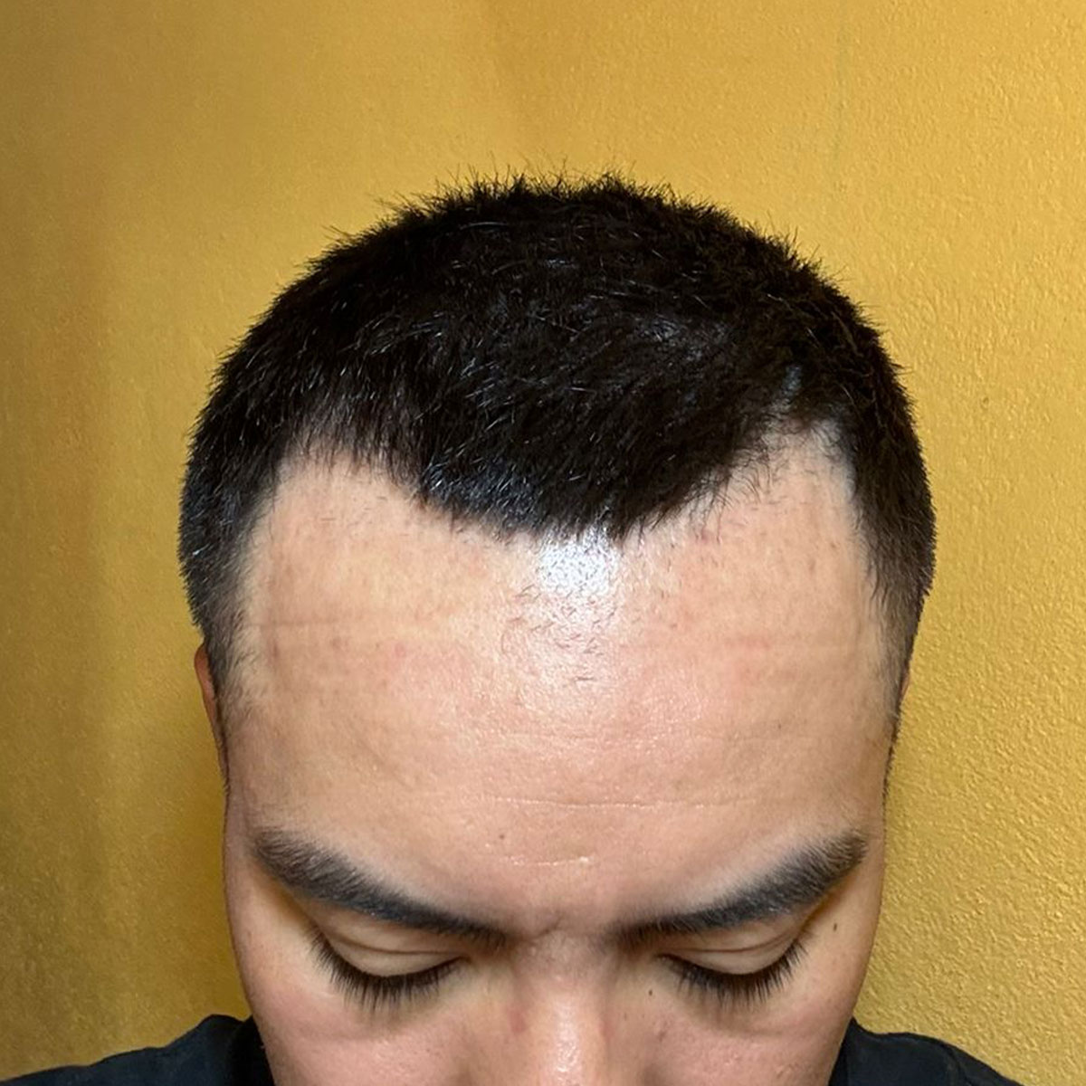 Antes