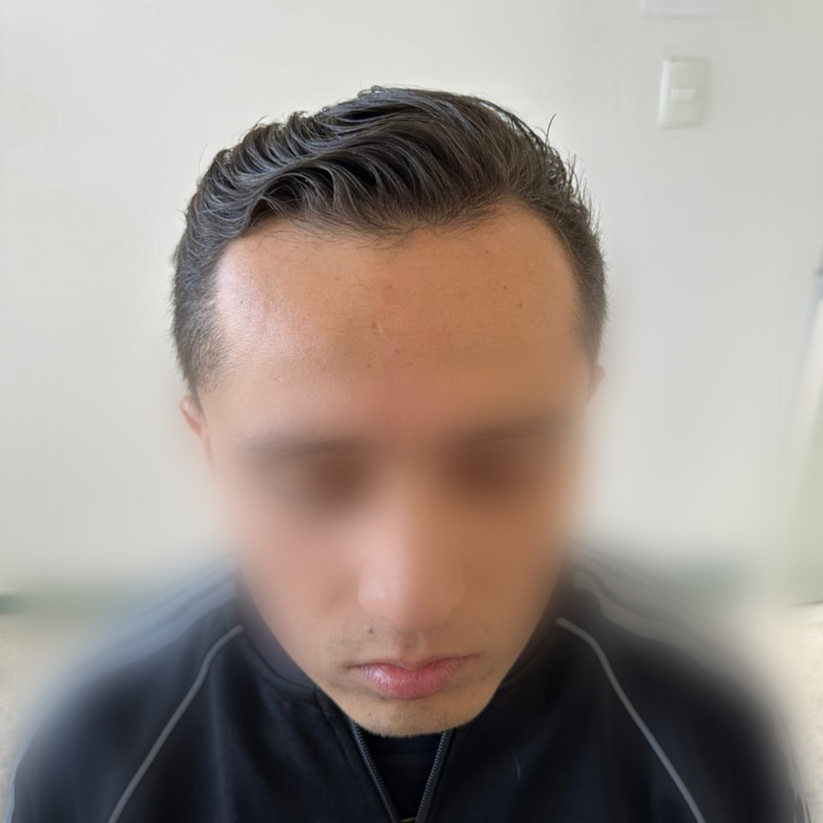 Antes