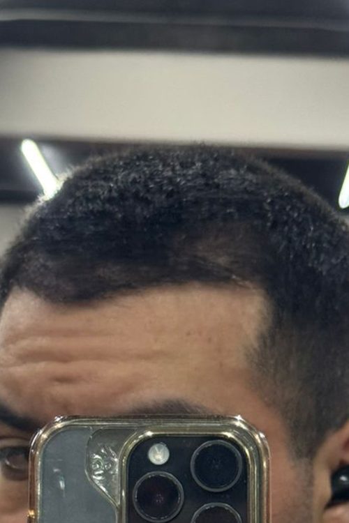 Proceso 2