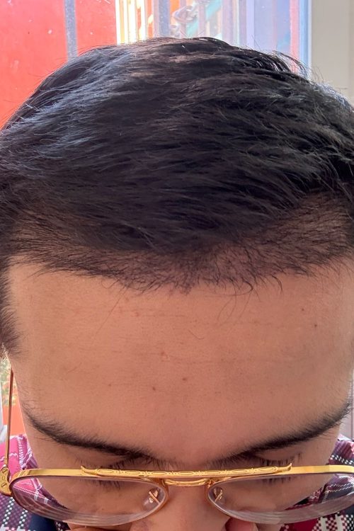 Proceso 2