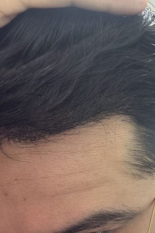 Proceso 4