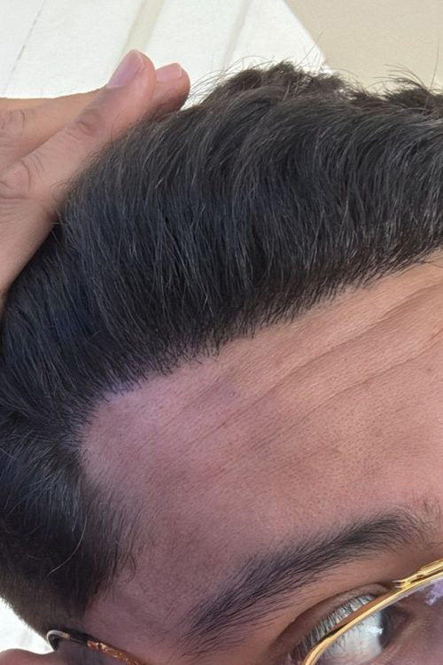Proceso 5